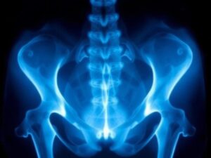 كيف تتم اشعة الحوض المنزلية خطوة بخطوة