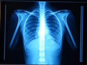 اشعة دوبلكس في المنزل بأفضل سعر