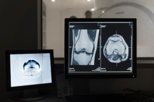 عمل اشعة باطنة فى المنزل وهل نتائجها دقيقة؟