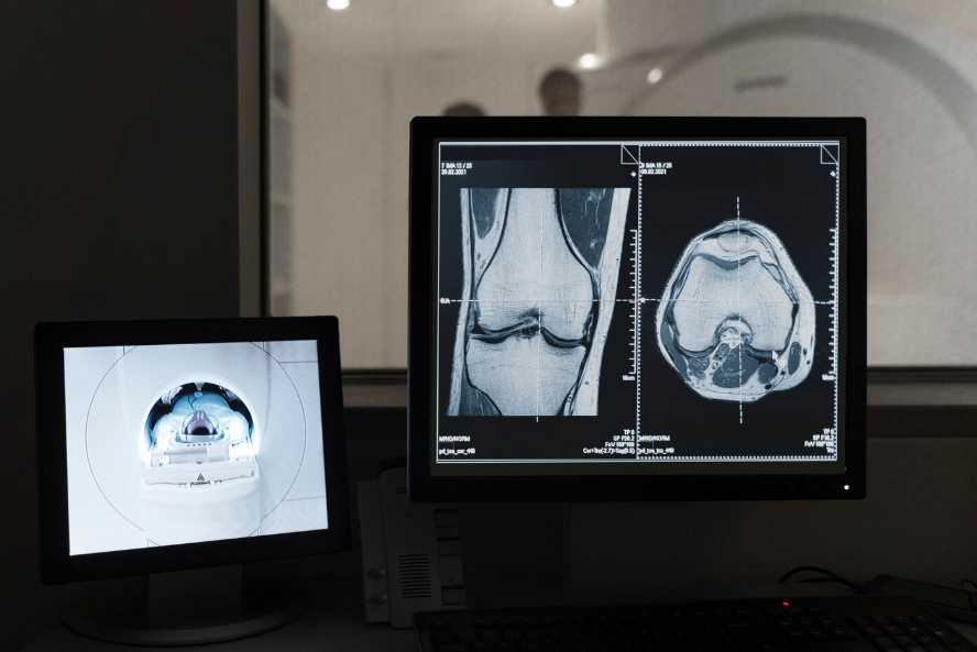 عمل اشعة باطنة فى المنزل وهل نتائجها دقيقة؟